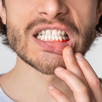 Supports Sensitive Gums